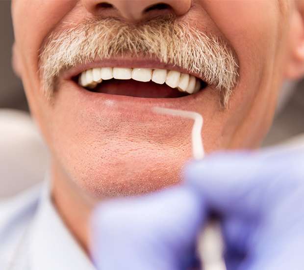 Oklahoma City Adjusting to New Dentures