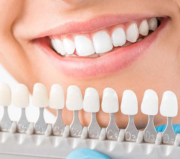Oklahoma City Cosmetic Dentist