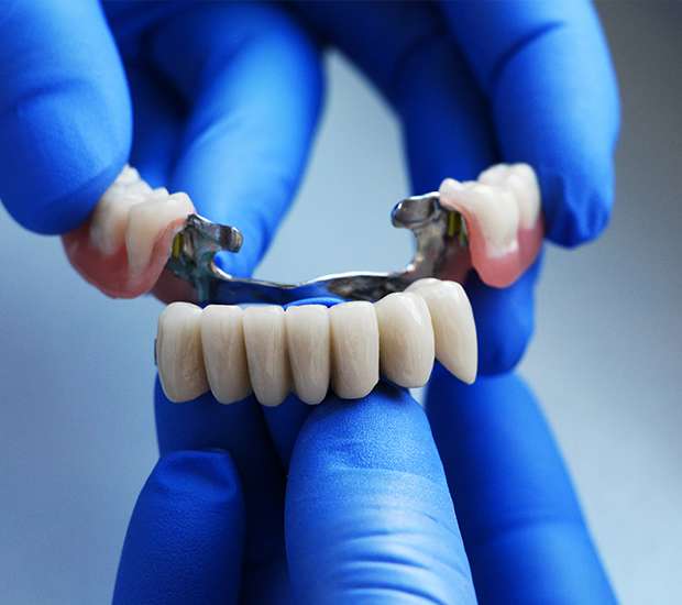 Oklahoma City Dental Bridges
