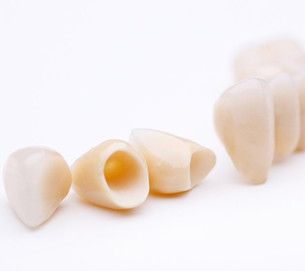 Oklahoma City Dental Crowns and Dental Bridges