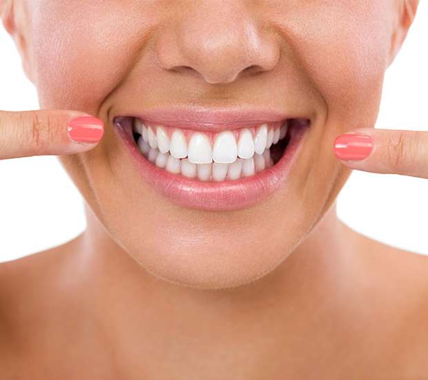 Oklahoma City What Is Gum Contouring and Reshaping