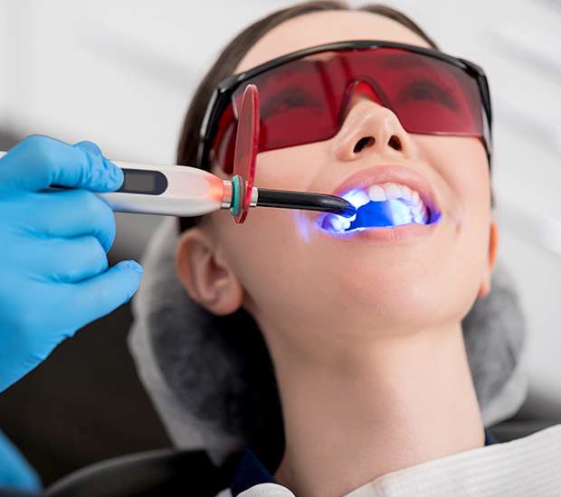 Oklahoma City Professional Teeth Whitening